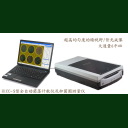 點擊查看 HiCC-Z全自動菌落計數(shù)、抑菌圈測量、β-內酰胺酶檢驗儀 詳細
